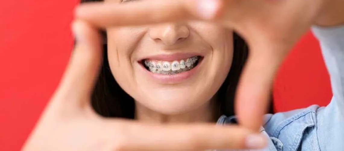 Jak działa aparat ortodontyczny i co powinieneś o nim wiedzieć